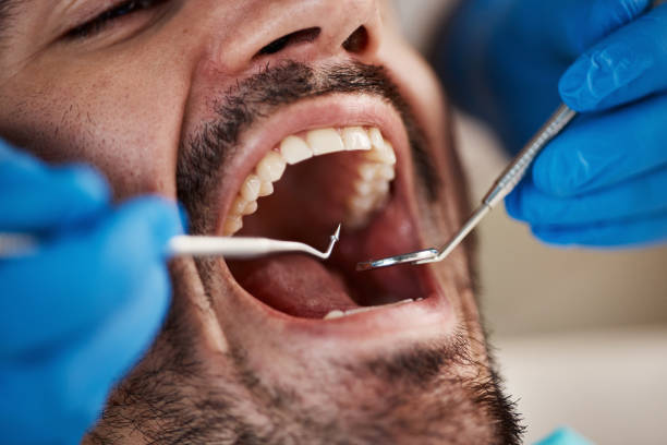 Best Emergency Broken Tooth Repair in Dunkirk, MD